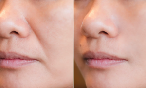 “I feel like I’ve had a facelift”: what if your moisturizer could finally erase your wrinkles?