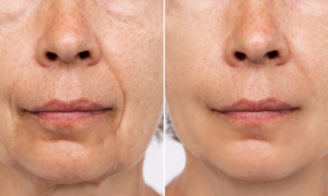 "I have rarely seen such a hydrating mask" : this new product transforms the skin in 15 minutes flat