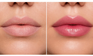 This Nivea anti-aging treatment at a low price smoothes the lips and protects them from the sun for 24 hours