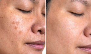 This SPF50+ sunscreen enriched with vitamin C slows down skin aging and reduces spots