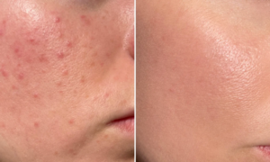 "Fast and efficient, I finally enjoy doing my skincare" : this mist contains treatments that soothe irritations