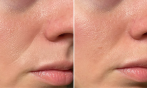 "My dehydration lines have become invisible" : this Sephora anti-wrinkle cream enriched with peptides plumps the skin deeply