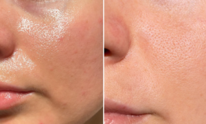 "I no longer shine all day since I applied it in the morning" : this mattifying fluid available in pharmacies, targets 7 types of imperfections