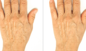 "My brown spots on my hands are gone" : this anti-aging hand cream with patented active ingredients targets 3 signs of aging