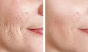 Bye bye fine lines: this day cream enriched with peptides and hyaluronic acid hydrates the skin and visibly reduces fine lines from dehydration