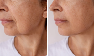 Expression lines: this ultra-powerful $10 wrinkle filler instantly smoothes to provide an immediate lifting effect and prevent sagging skin