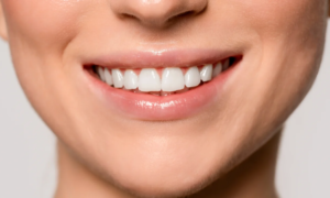 Teeth whitening: no longer pay $1,000 to the dentist, this method for less than $100 impresses even the pros
