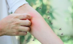 These anti-mosquito bite dressings relieve itching quickly and last for several days