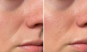 “82% say their fine lines are reduced in 21 days”: this anti-aging plumping serum with global action acts on wrinkles, skin texture and complexion.