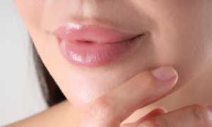“Every time I apply it, I’m asked if I’ve had injections”: this gloss, available at Sephora, contains a tailor-made plumping complex for visibly fuller lips