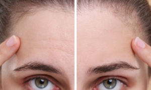 Forehead wrinkles: this 5-in-1 milk-cream enriched with plant-based retinol smoothes the face and neck, but can also be used as a makeup base