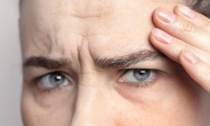 Forehead wrinkles: this Yves Rocher serum, whose effectiveness has been clinically proven, lifts even the deepest wrinkles