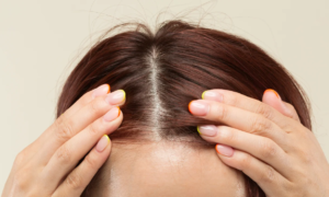 Hair growth: these 3 actions on the scalp help you gain centimeters very quickly