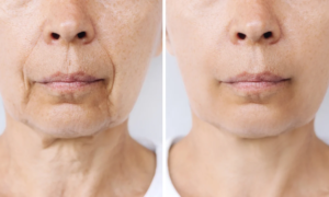 “I definitely said goodbye to unsightly wrinkles”: this inexpensive organic wrinkle filler visibly blurs wrinkles, fine lines and irregularities in five minutes