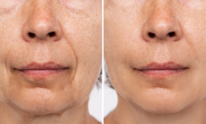 “I feel like I’ve gained 10 years of age”: this peach skin effect anti-wrinkle cream reverses the signs of aging and gives bounce to the skin