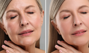 “I got my 20s back”: this Neutrogena anti-aging night cream has an innovative and, above all, powerful formulation with pure retinol and highly active vitamin A