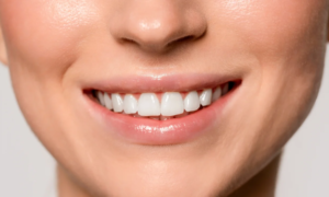 “I’ve never had teeth so white in my life”: this purple-blue toothpaste features a dual color-correcting formula that eliminates stains over the long term
