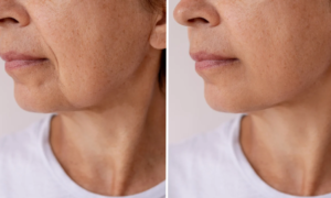 “My flabby skin has finally tightened”: this cream improves skin elasticity and smoothes fine lines, reducing the signs of aging