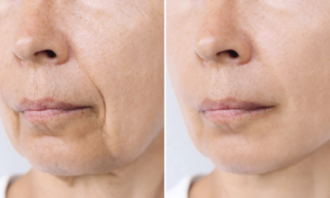“My skin looks 3 years younger”: this innovation targets 9 signs of skin aging with a formula equipped with a new, high-performance complex