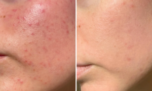 “My spots have vanished”: this anti-spot radiance serum with turmeric fades 80% of spots for a more even complexion result