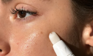 Return of spots after summer: this treatment acts like an invisible bandage for the skin