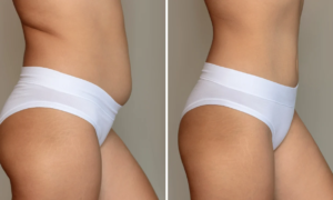 Body fat: this sports accessory for less than $15 strengthens deep muscles (suitable for beginners and experts)
