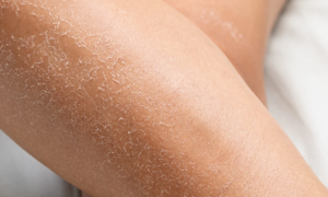 Goodbye "lizard skin" : this Kiehl’s whipped cream saves ultra-dry skin for 24 hours