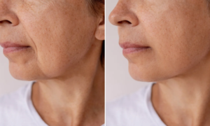 “My anti-wrinkle secret costs less than $20”: the new L’Oréal Paris serum that’s causing the buzz
