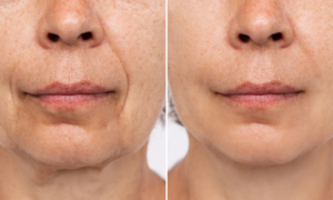 “My husband is convinced I had Botox”: this Aroma-Zone anti-wrinkle cream smoothed my skin overnight