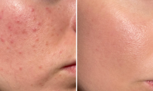 “My skin is so luminous that it looks like a filter”: this duo of complementary anti-spot treatments for less than 30 euros targets spots in 7 days
