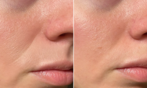 “My skin was tight as soon as I woke up”: this $6 Mixa balm smoothed my fine lines in just one night