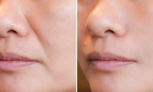“My wrinkles have tightened before my eyes”: this anti-wrinkle treatment acts effectively on the visible signs of aging thanks to three powerful forms of retinoids